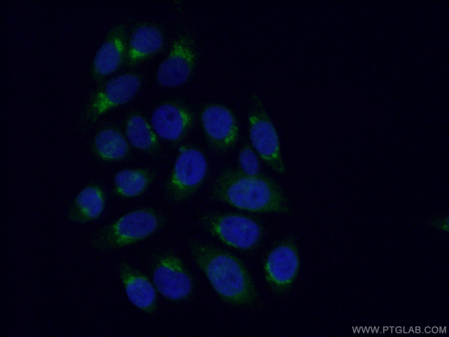 GOSR2/Membrin Antibody in Immunocytochemistry (ICC/IF)