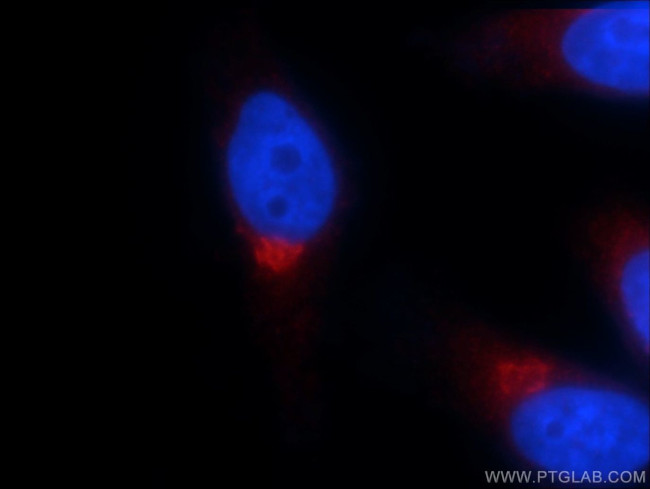 GOSR2/Membrin Antibody in Immunocytochemistry (ICC/IF)