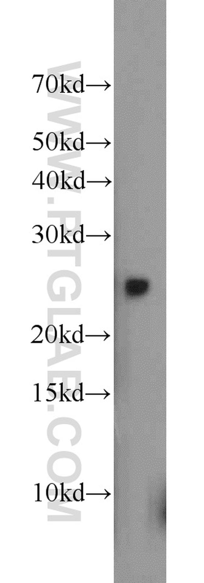 GOSR2/Membrin Antibody in Western Blot (WB)