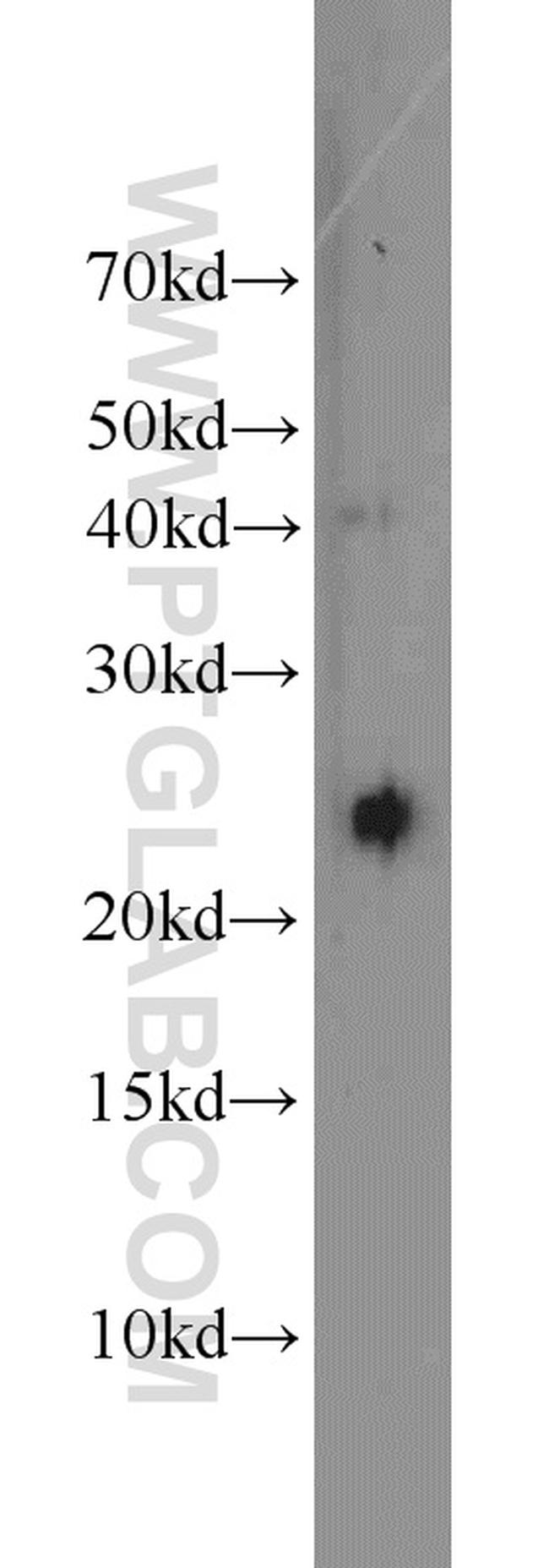 GOSR2/Membrin Antibody in Western Blot (WB)