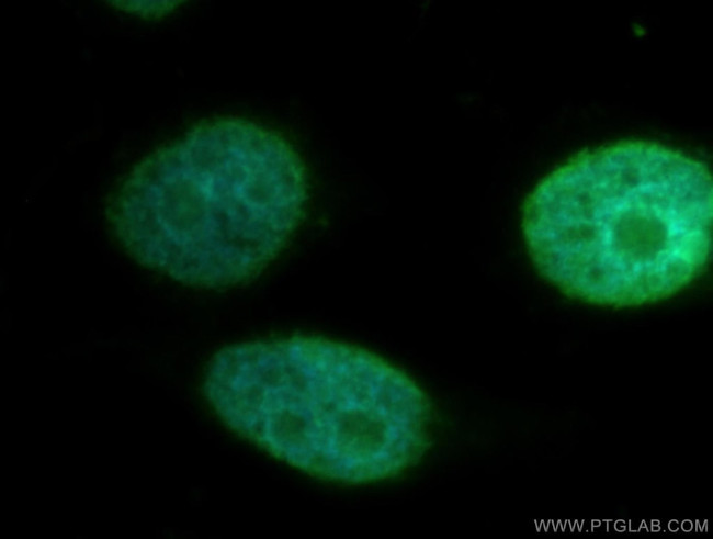 STK3 Antibody in Immunocytochemistry (ICC/IF)