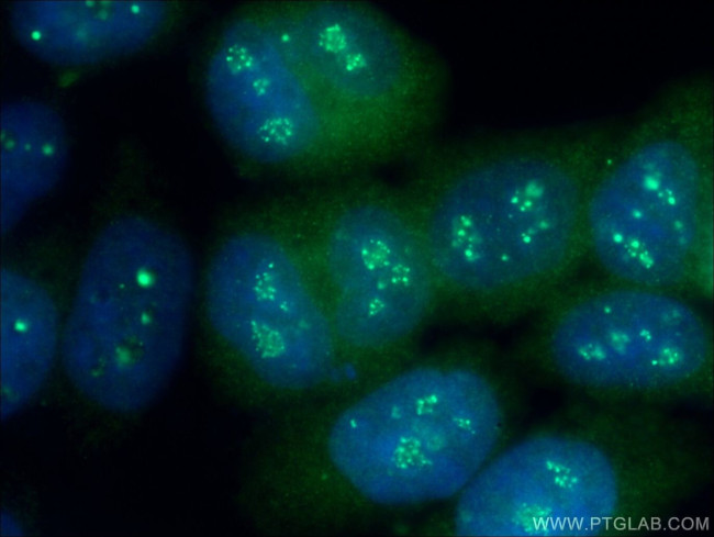 STK3 Antibody in Immunocytochemistry (ICC/IF)