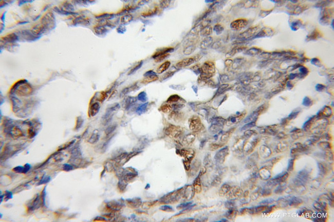 STK3 Antibody in Immunohistochemistry (Paraffin) (IHC (P))