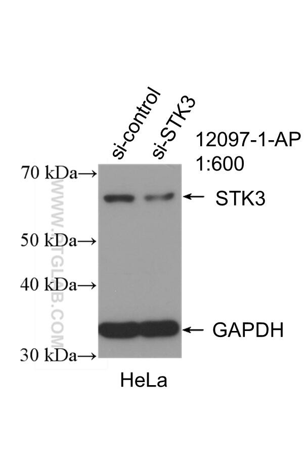 STK3 Antibody in Western Blot (WB)