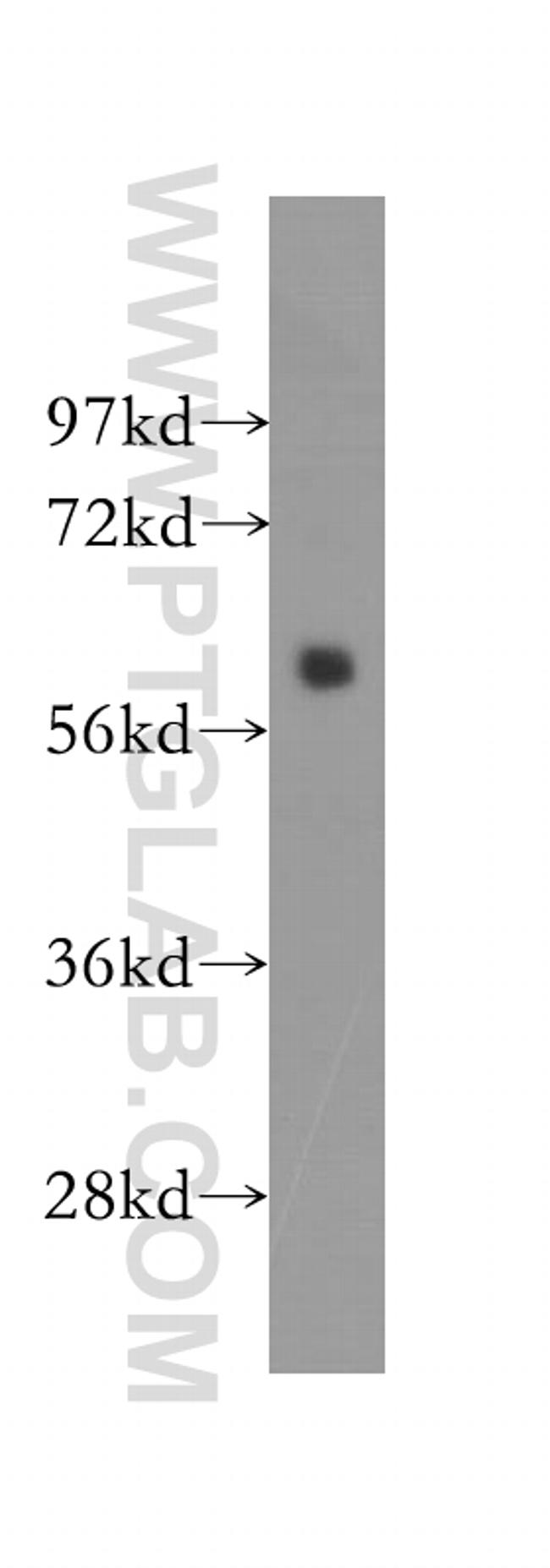 STK3 Antibody in Western Blot (WB)