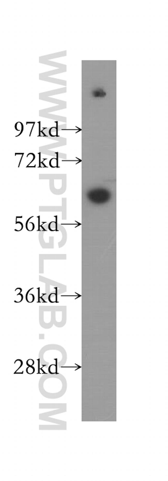 STK3 Antibody in Western Blot (WB)