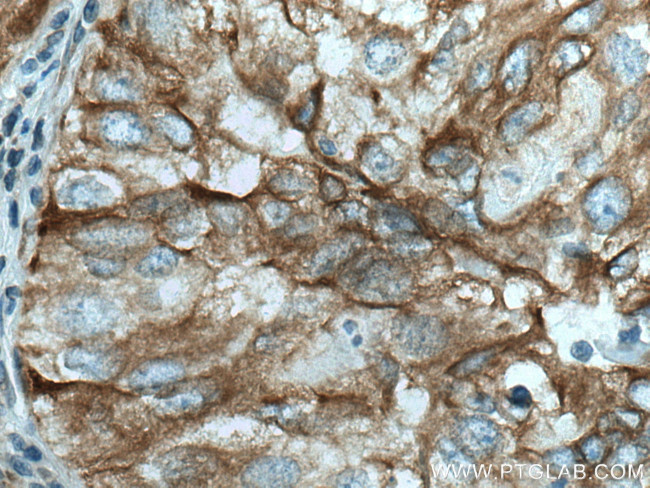 PBXIP1 Antibody in Immunohistochemistry (Paraffin) (IHC (P))