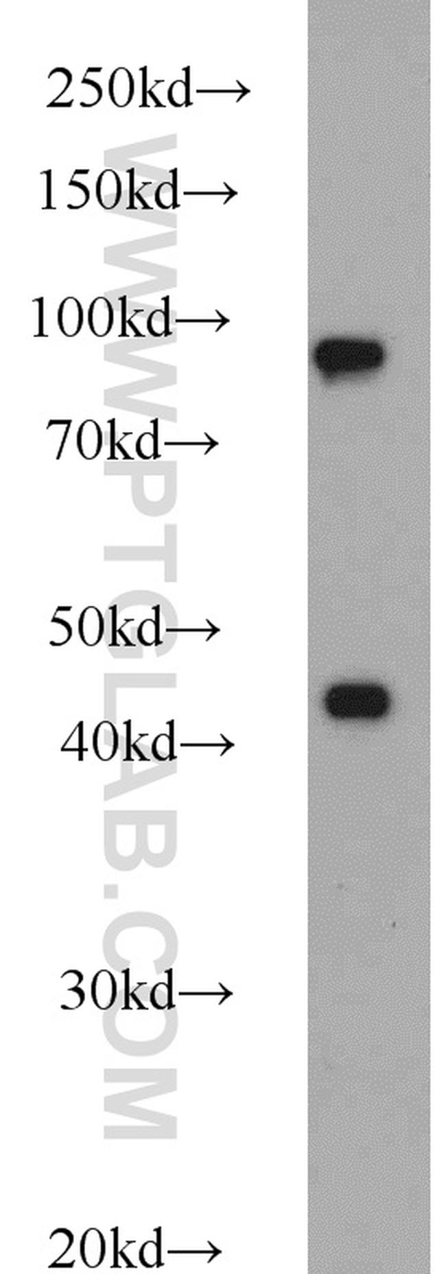 PBXIP1 Antibody in Western Blot (WB)