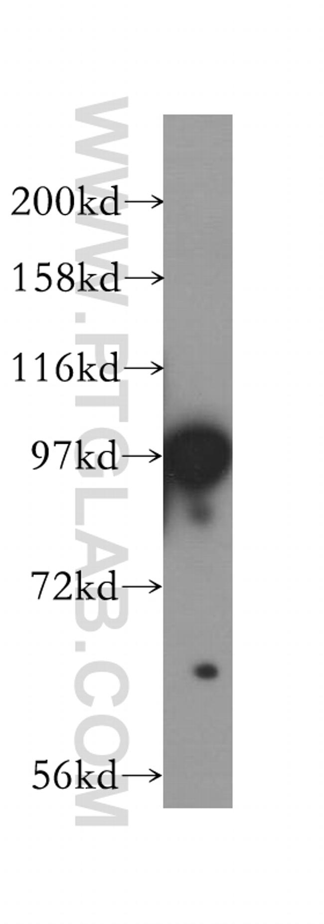 PBXIP1 Antibody in Western Blot (WB)