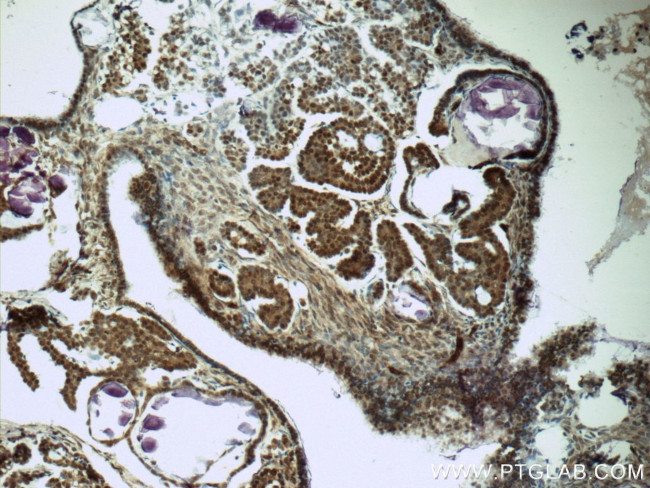 SPIN1 Antibody in Immunohistochemistry (Paraffin) (IHC (P))