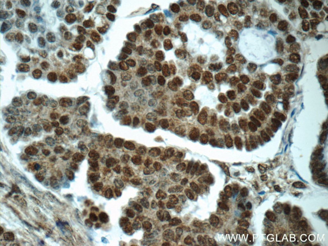 SPIN1 Antibody in Immunohistochemistry (Paraffin) (IHC (P))