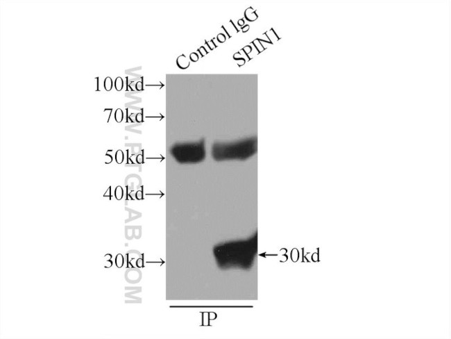 SPIN1 Antibody in Immunoprecipitation (IP)