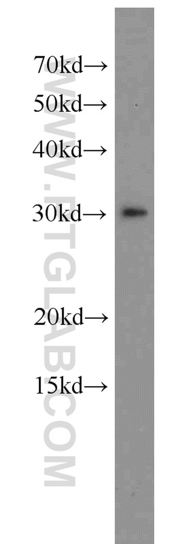 SPIN1 Antibody in Western Blot (WB)