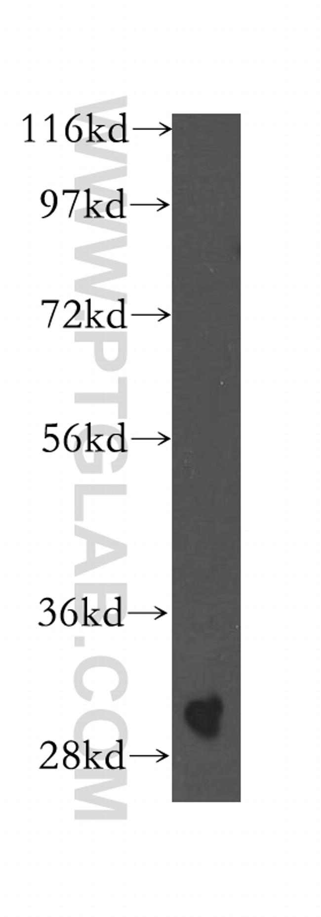 SPIN1 Antibody in Western Blot (WB)