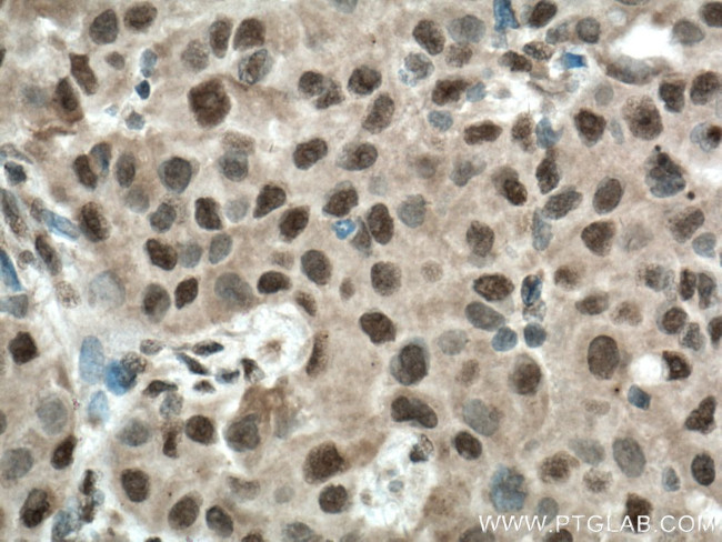 BCOR Antibody in Immunohistochemistry (Paraffin) (IHC (P))