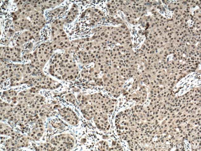 BCOR Antibody in Immunohistochemistry (Paraffin) (IHC (P))