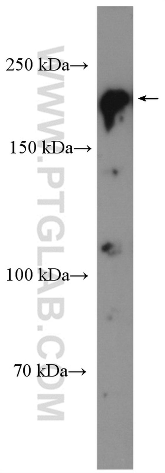 BCOR Antibody in Western Blot (WB)