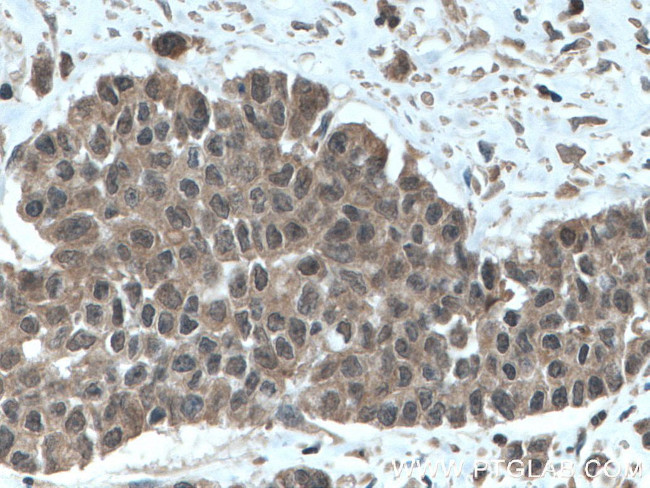 TRIM21 Antibody in Immunohistochemistry (Paraffin) (IHC (P))