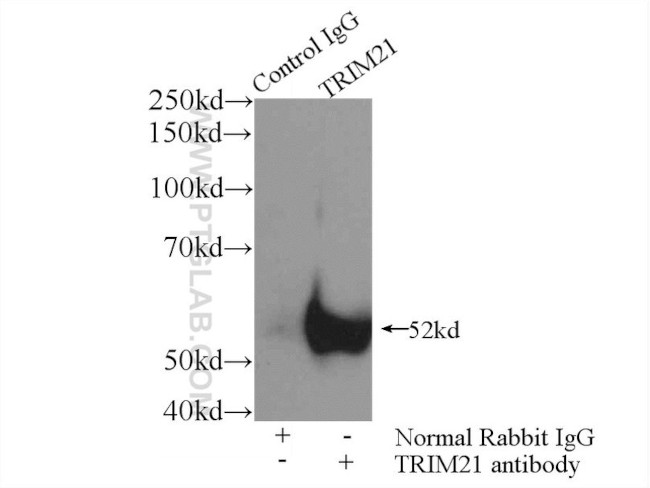 TRIM21 Antibody in Immunoprecipitation (IP)