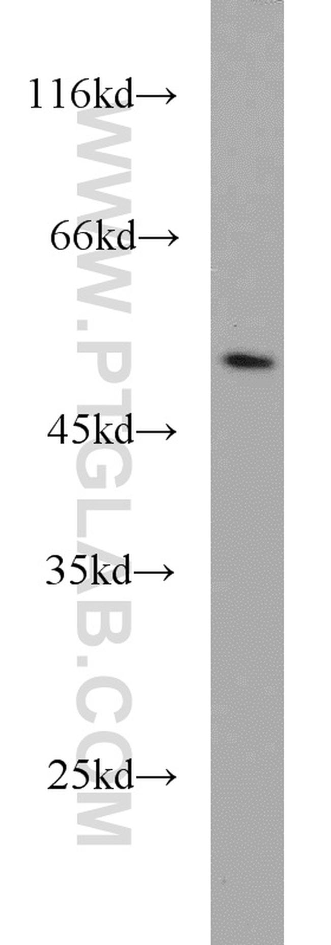 TRIM21 Antibody in Western Blot (WB)