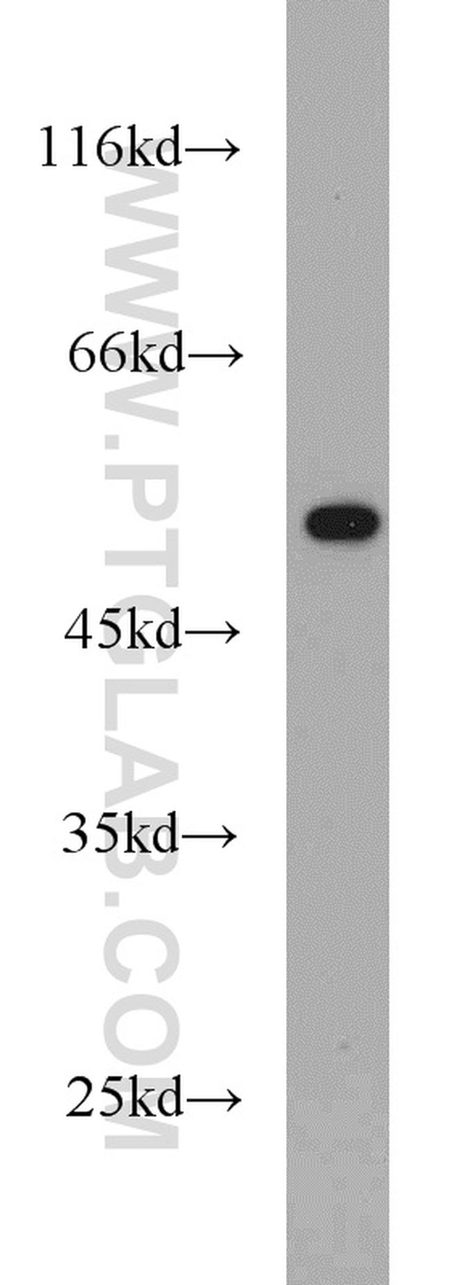 TRIM21 Antibody in Western Blot (WB)