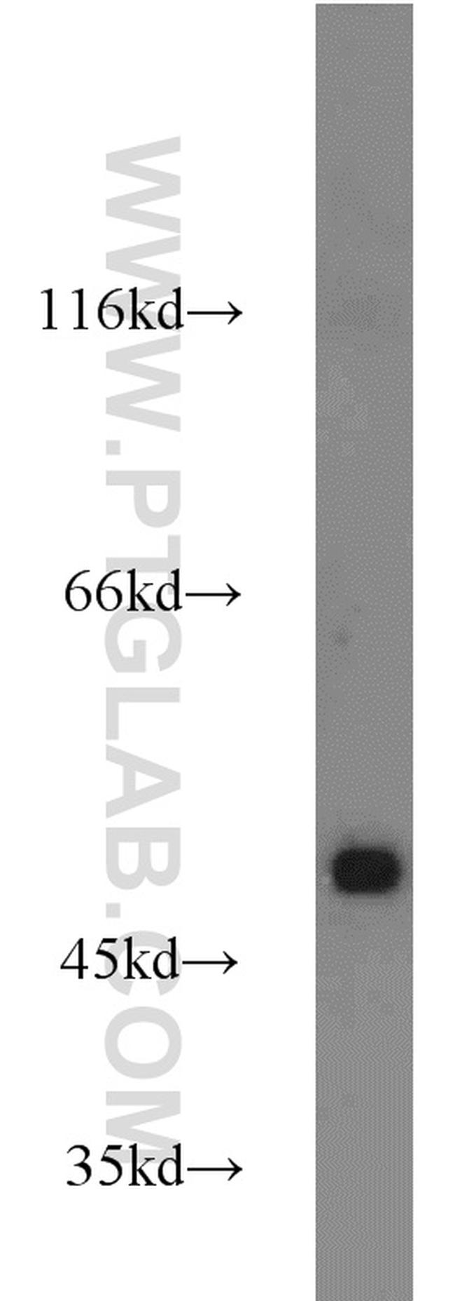 TRIM21 Antibody in Western Blot (WB)