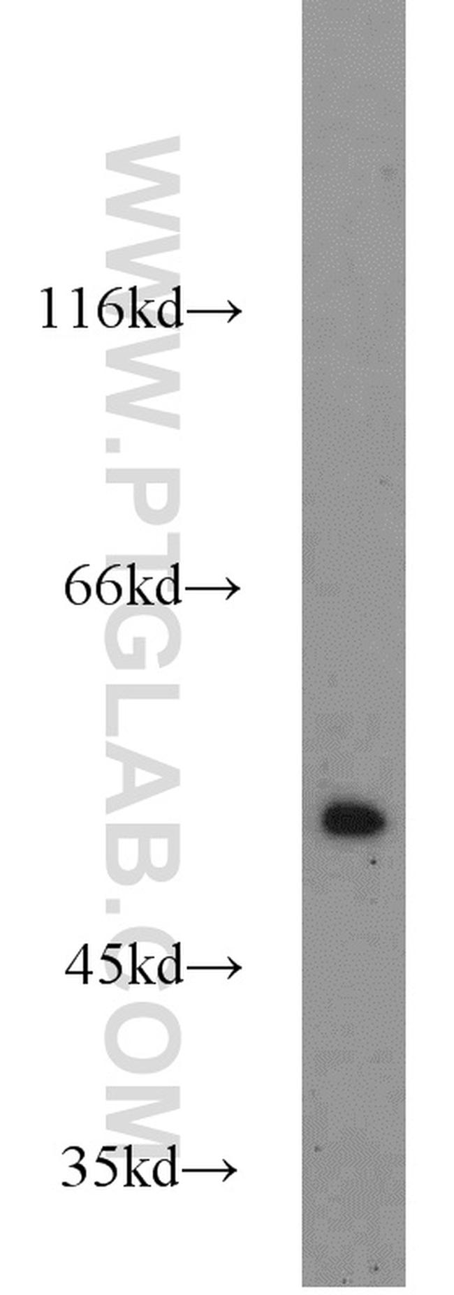 TRIM21 Antibody in Western Blot (WB)