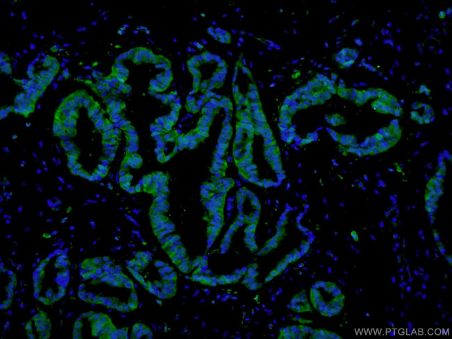 PADI2 Antibody in Immunohistochemistry (PFA fixed) (IHC (PFA))