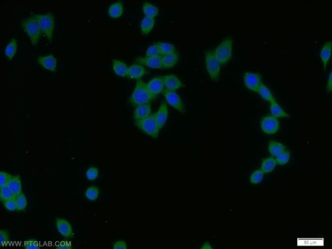 PADI2 Antibody in Immunocytochemistry (ICC/IF)