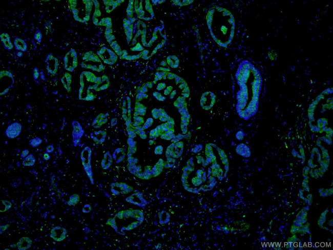 PADI2 Antibody in Immunohistochemistry (PFA fixed) (IHC (PFA))