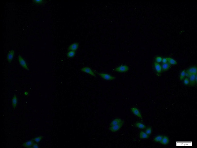 PADI2 Antibody in Immunocytochemistry (ICC/IF)