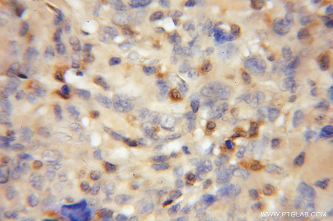 PADI2 Antibody in Immunohistochemistry (Paraffin) (IHC (P))