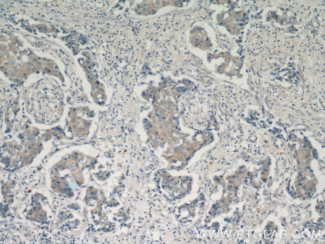 PADI2 Antibody in Immunohistochemistry (Paraffin) (IHC (P))