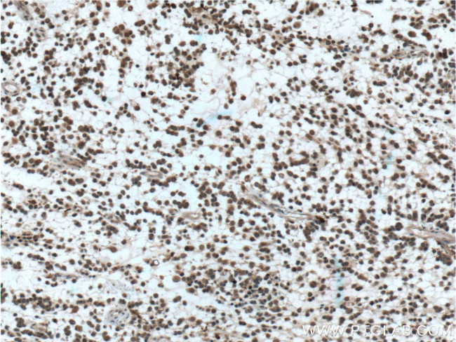 PADI2 Antibody in Immunohistochemistry (Paraffin) (IHC (P))