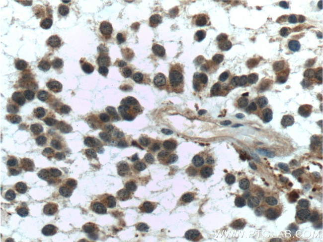 PADI2 Antibody in Immunohistochemistry (Paraffin) (IHC (P))