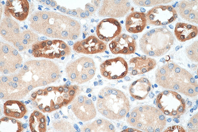 PADI2 Antibody in Immunohistochemistry (Paraffin) (IHC (P))