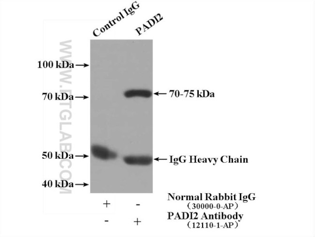 PADI2 Antibody in Immunoprecipitation (IP)