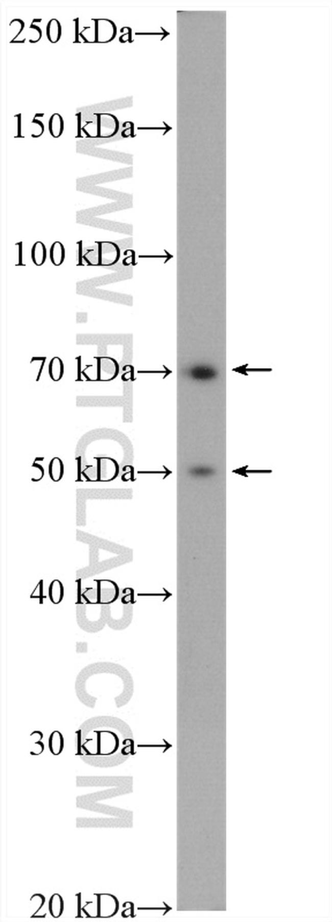 PADI2 Antibody in Western Blot (WB)