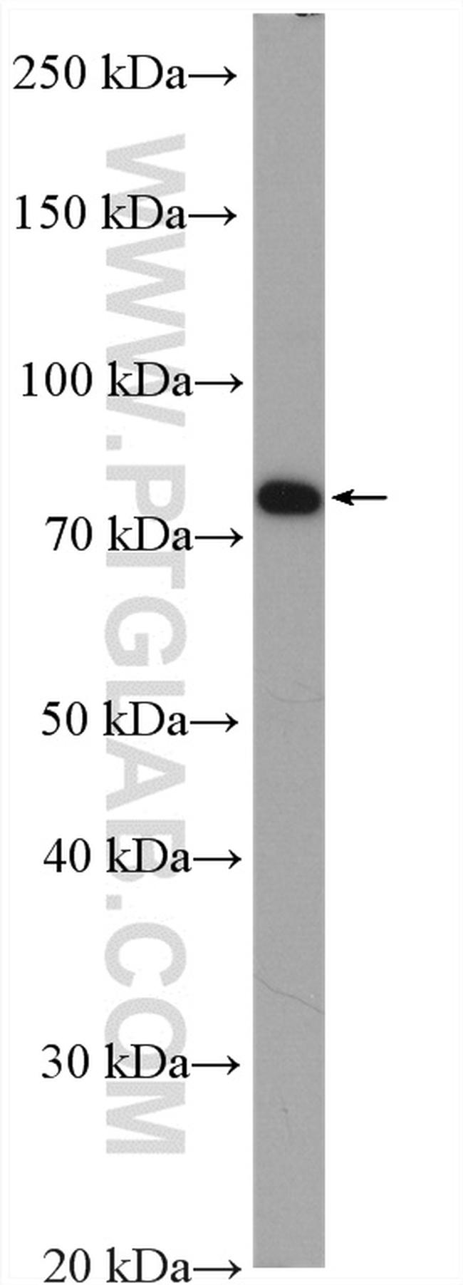 PADI2 Antibody in Western Blot (WB)