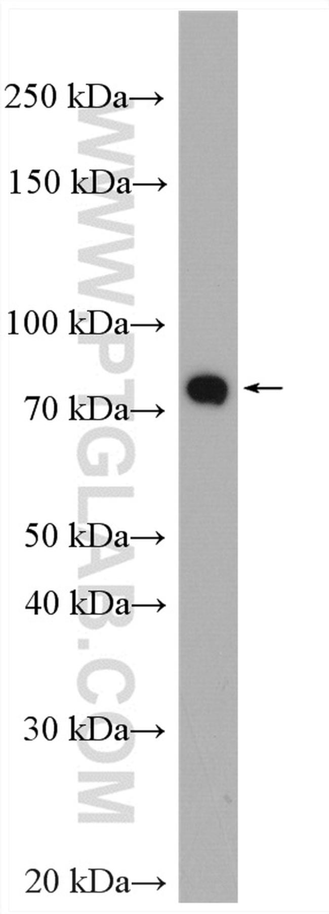 PADI2 Antibody in Western Blot (WB)