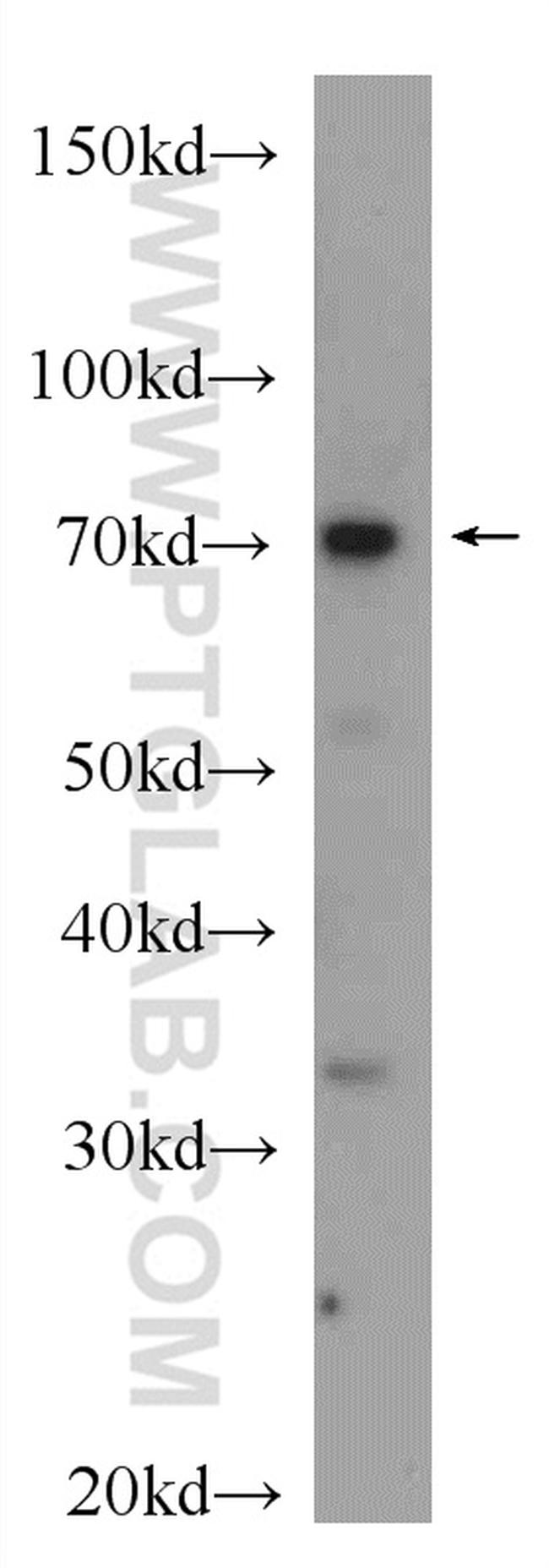 PADI2 Antibody in Western Blot (WB)