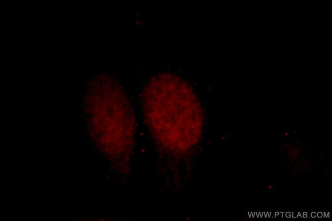 DPF2 Antibody in Immunocytochemistry (ICC/IF)