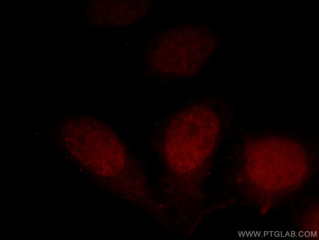 DPF2 Antibody in Immunocytochemistry (ICC/IF)