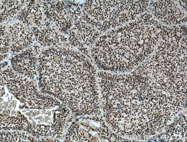 DPF2 Antibody in Immunohistochemistry (Paraffin) (IHC (P))