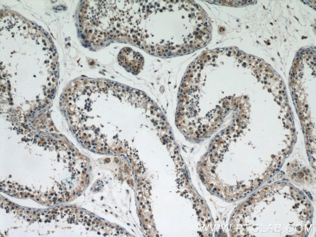 DPF2 Antibody in Immunohistochemistry (Paraffin) (IHC (P))