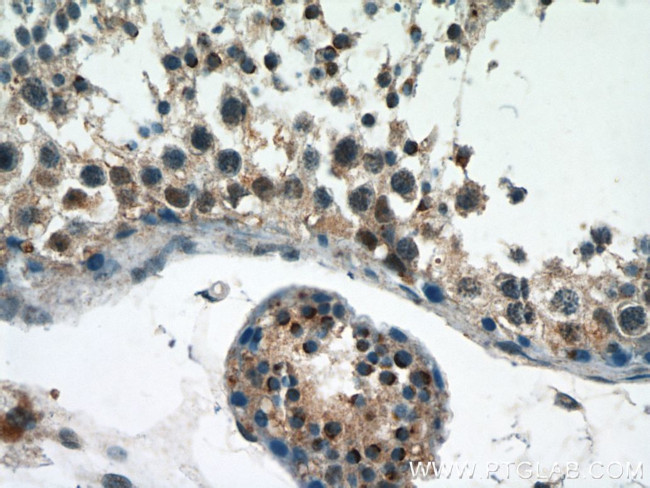 DPF2 Antibody in Immunohistochemistry (Paraffin) (IHC (P))