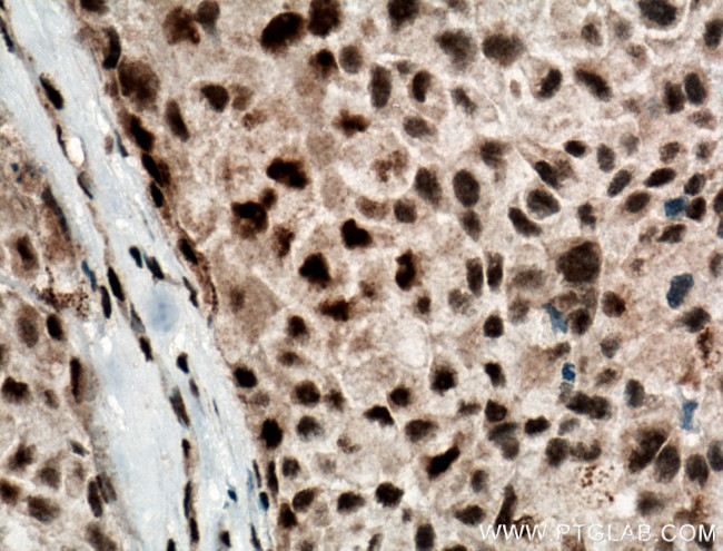 DPF2 Antibody in Immunohistochemistry (Paraffin) (IHC (P))