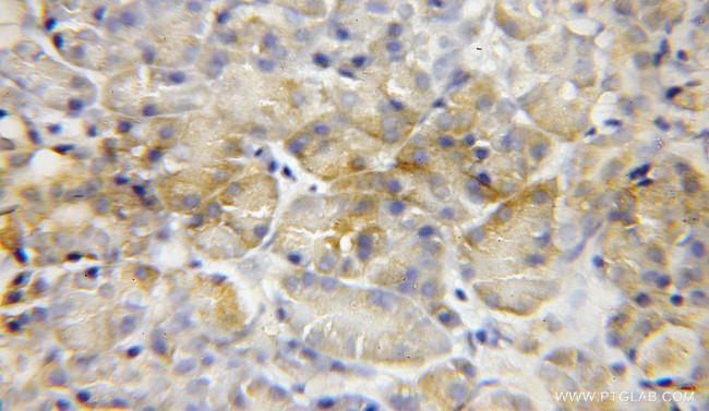 MCCC2 Antibody in Immunohistochemistry (Paraffin) (IHC (P))