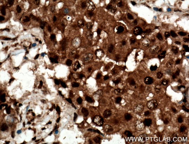 RAD23B Antibody in Immunohistochemistry (Paraffin) (IHC (P))