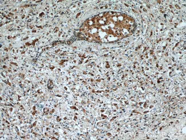 RAD23B Antibody in Immunohistochemistry (Paraffin) (IHC (P))